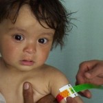 malnutrition